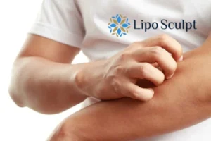 Best Actinic Keratoses Removal 4 prevent your actinic keratoses Lowestoft getting worse - call our team today!