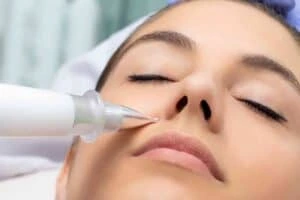 Best Actinic Keratoses Removal 3 Actinic keratoses Lowestoft solutions - book in today!