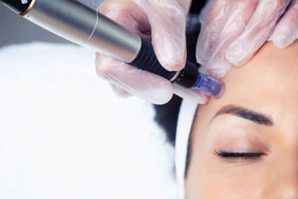 Explaining Total Skin Tightening Treatment and What to Expect 2 What Skin Concerns Can Total Skin Tightening Treatment Help With Lowestoft?