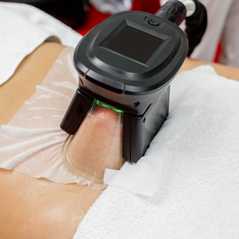 Fat Freezing treatment Lowestoft
